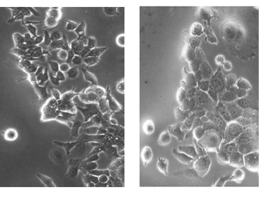 Cambios morfológicos en el proceso metastásico inducidos por los extractos de hongos